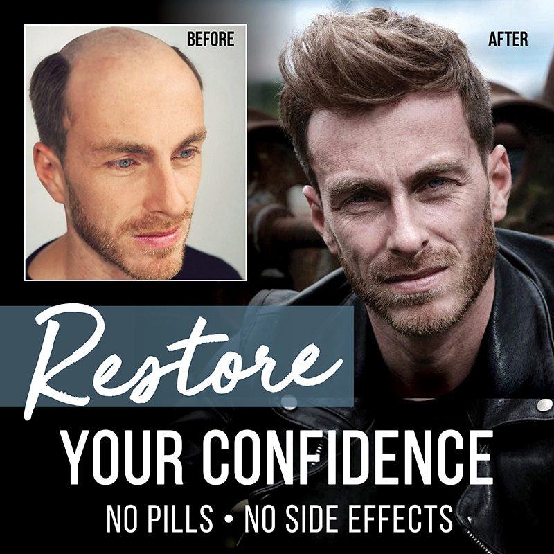 GG Restore Confidence Hair System