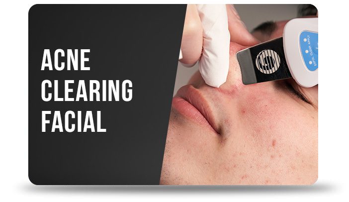 Image of Guys Grooming Acne Clearing Facial Gift Card